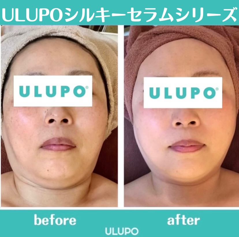 ULUPOシリーズ